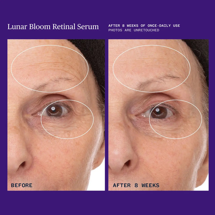 Lunar Bloom Retinal Serum